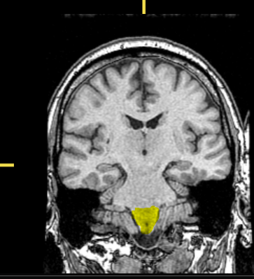 <p>What part of the brain is highlighted?</p>