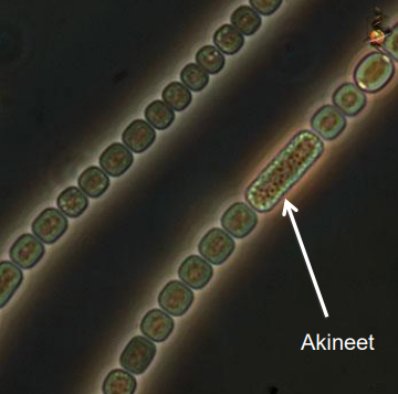 <p>Anabaena</p>