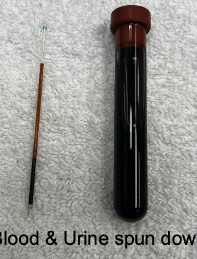 <p>-history and clinical signs</p><p>-high copper concentration in blood and liver</p><p>-in acute hemolytic phase: severe non-regen. anemia</p><p>-in pre-hemolytic phase of chronic toxicosis: elevated liver enzymes, high copper conc. in liver biopsy</p><p>with chronic copper toxicity, stressors can induce a hemolytic crisis</p>