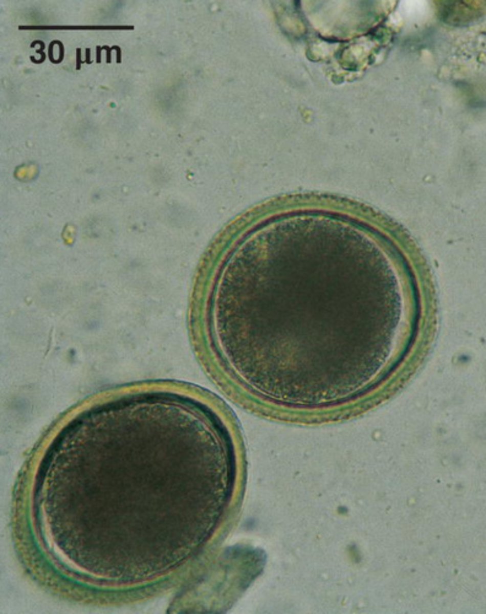 <p>What is this parasite is this if it is from a cat</p>