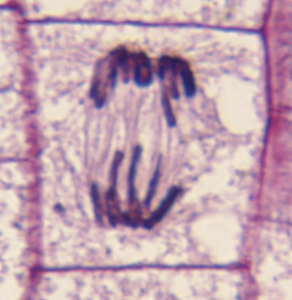 <p>Which phase of mitosis is this? Why is it important? </p>