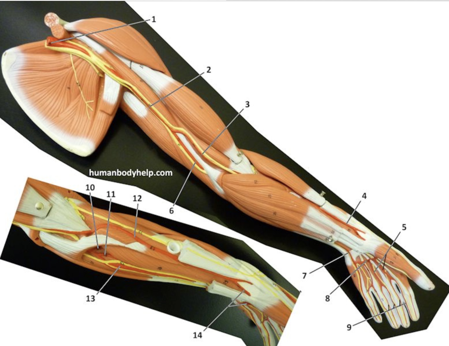 <p>What is the artery labeled #2?</p>