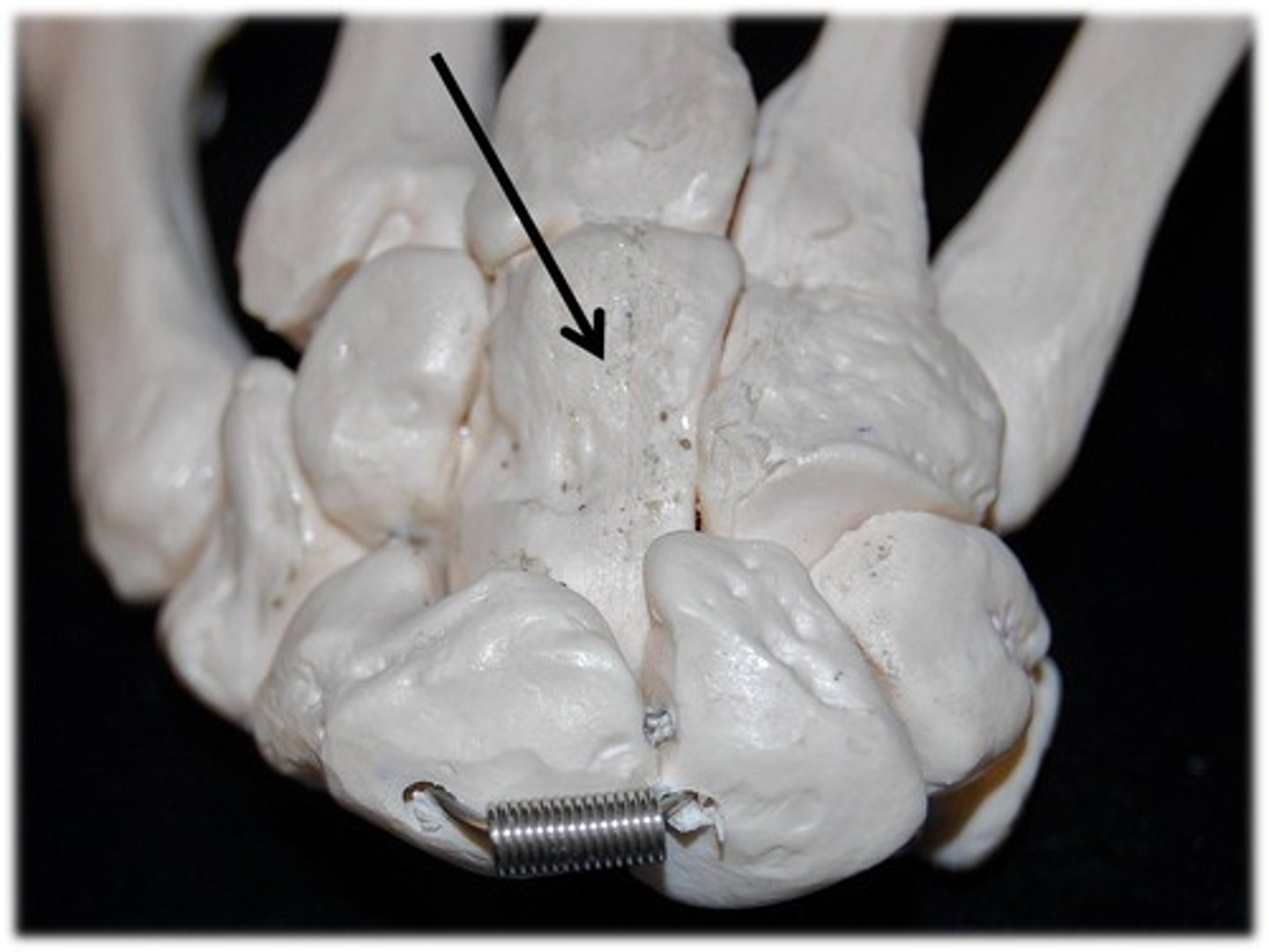 <p>Name this carpal bone (posterior view).</p>