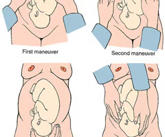<p><span>determines the baby's position in the mom's uterus</span></p>