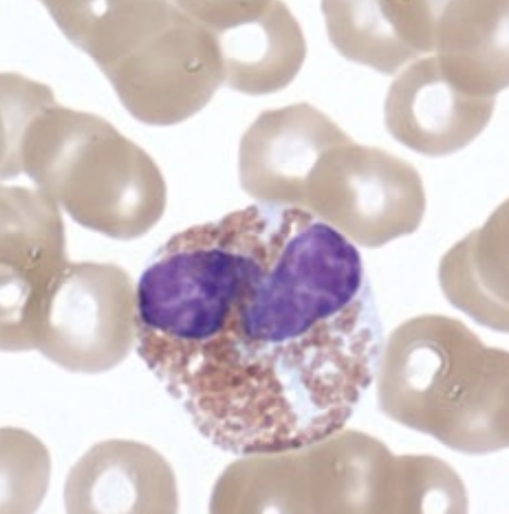 <p><strong>granular leukocytes: eosinophils</strong></p><ul><li><p>absorb eosin stain (acidic) → red/orange</p><ul><li><p>2-3 lobed nuclei</p></li><li><p>granules do not obscure nuclei</p></li></ul></li><li><p>life span < 2 weeks</p></li><li><p>phagocytic (limited)</p></li><li><p>chemotaxic</p></li><li><p>degranulation (enzymes)</p><ul><li><p>_______ and _______</p></li><li><p>major basic protein</p><ul><li><p>kills endoparasites</p></li></ul></li></ul></li><li><p>~3% of WBCs</p></li></ul><p></p>