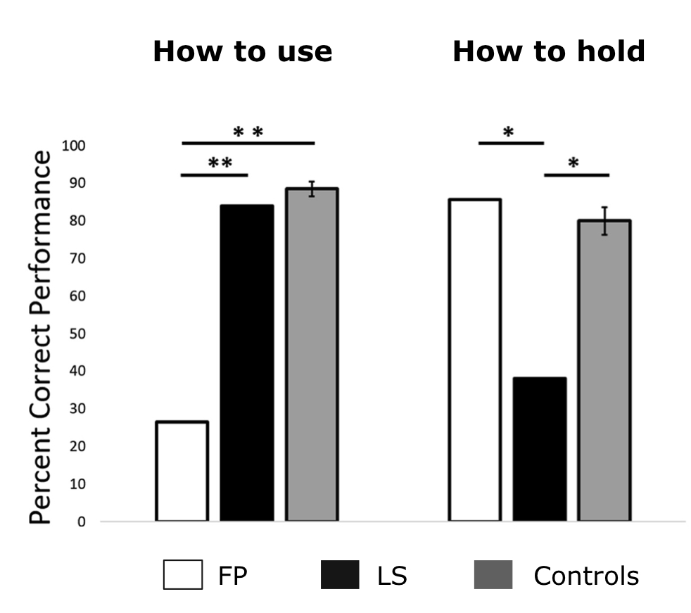 <ul><li><p>participant FP: difficulties pantomiming tool use (using a hammer), but was able to accurately judge an object’s manipulation (had lesions in left side of the brain)</p></li><li><p>participant LS: can pantomime tool use, but is impaired at performing manipulation judgements (lesions in frontal areas, motor areas, parietal lobe)</p></li><li><p>shows that tool-gesture production and tool-gesture knowledge can be behaviourally and neurally double-dissociated</p></li></ul><p></p>