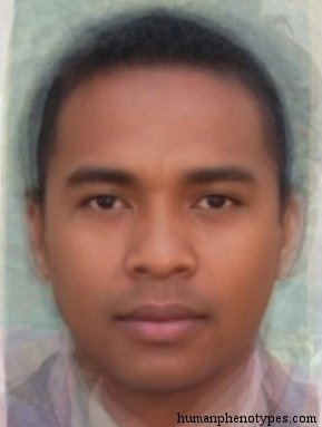 <p>Identify this Phenotype</p>