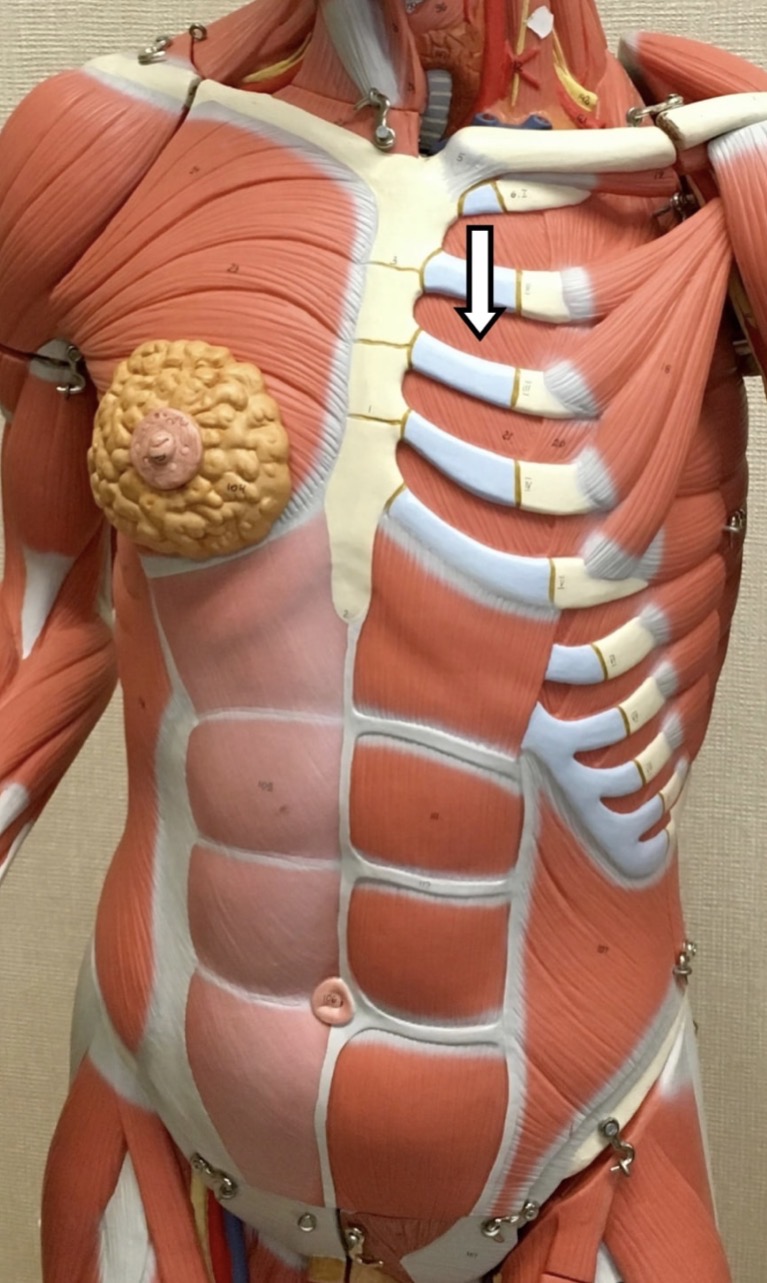 <p><span>Name the muscle labeled with the white arrow below:</span></p>