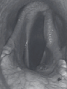<p>Dixon Grade?</p>