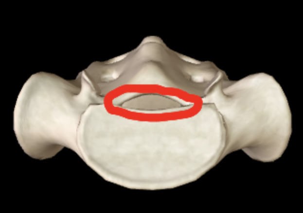 <p>Name this feature of the sacrum (superior view)</p>