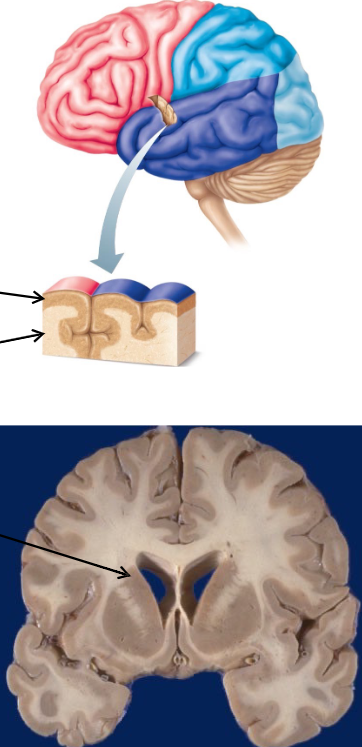 <ul><li><p>Cerebral Cortex = outer crust of cerebral gray matter, location of conscious mind</p></li><li><p>Cerebral White Matter = neuron fiber tracts deep to the cerebral cortex</p></li><li><p>Basal Nuclei (Basal Ganglia) = islands of gray matter buried within the white matter</p></li><li><p>Limbic System = gray and white matter structures dispersed thruout the cerebrum</p></li></ul><p></p>