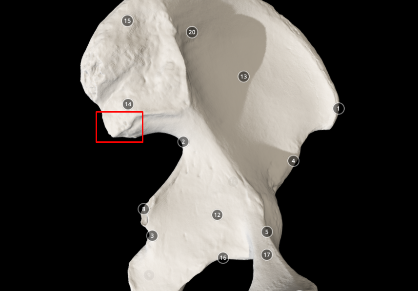 <p>posterior inferior iliac spine - point above the greater sciatic notch</p>