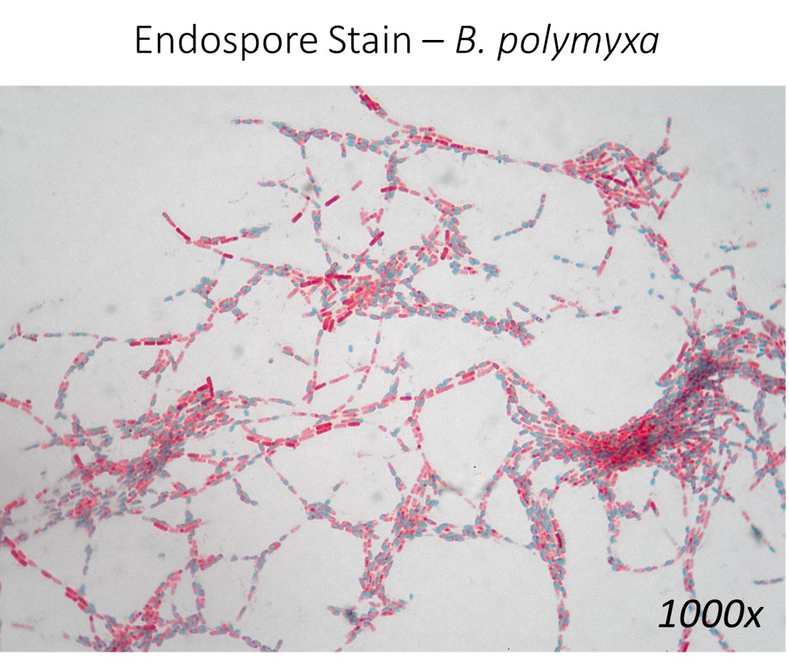 \-green is the endospore

\-red/pink is vegetative cell
