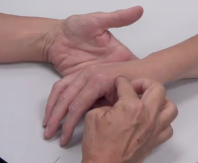 -Forearm on the table in a pronated position
-1st Dorsal Interossei (pointer finger, just below the lowest knuckle, in the web space)

**can't palpate the lumbricals
