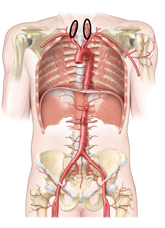 <p>An artery located in the neck that supplies blood to the head and brain.</p>