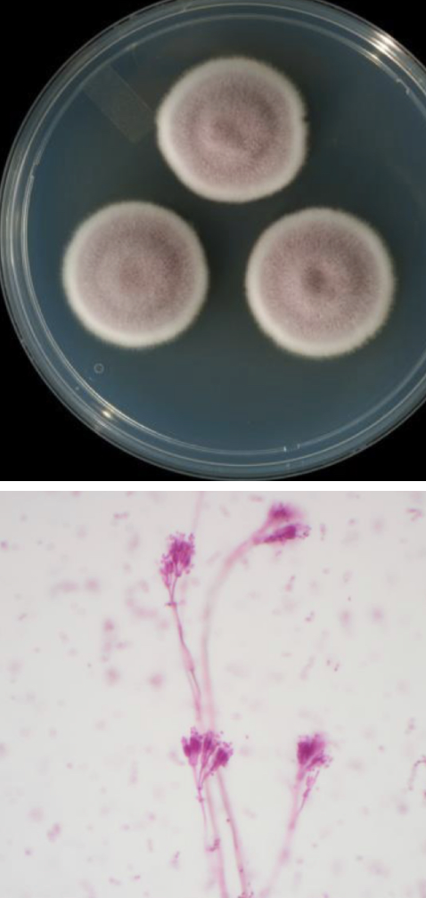 <p>Purpureocillium lilacinum</p>