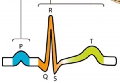 <p>What is the QRS complex showing</p>