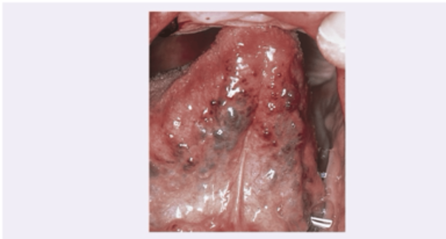 <p>Varicose veins clinical significance</p>
