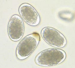 <p>looks the same as ancylostoma but only infects ruminants </p>