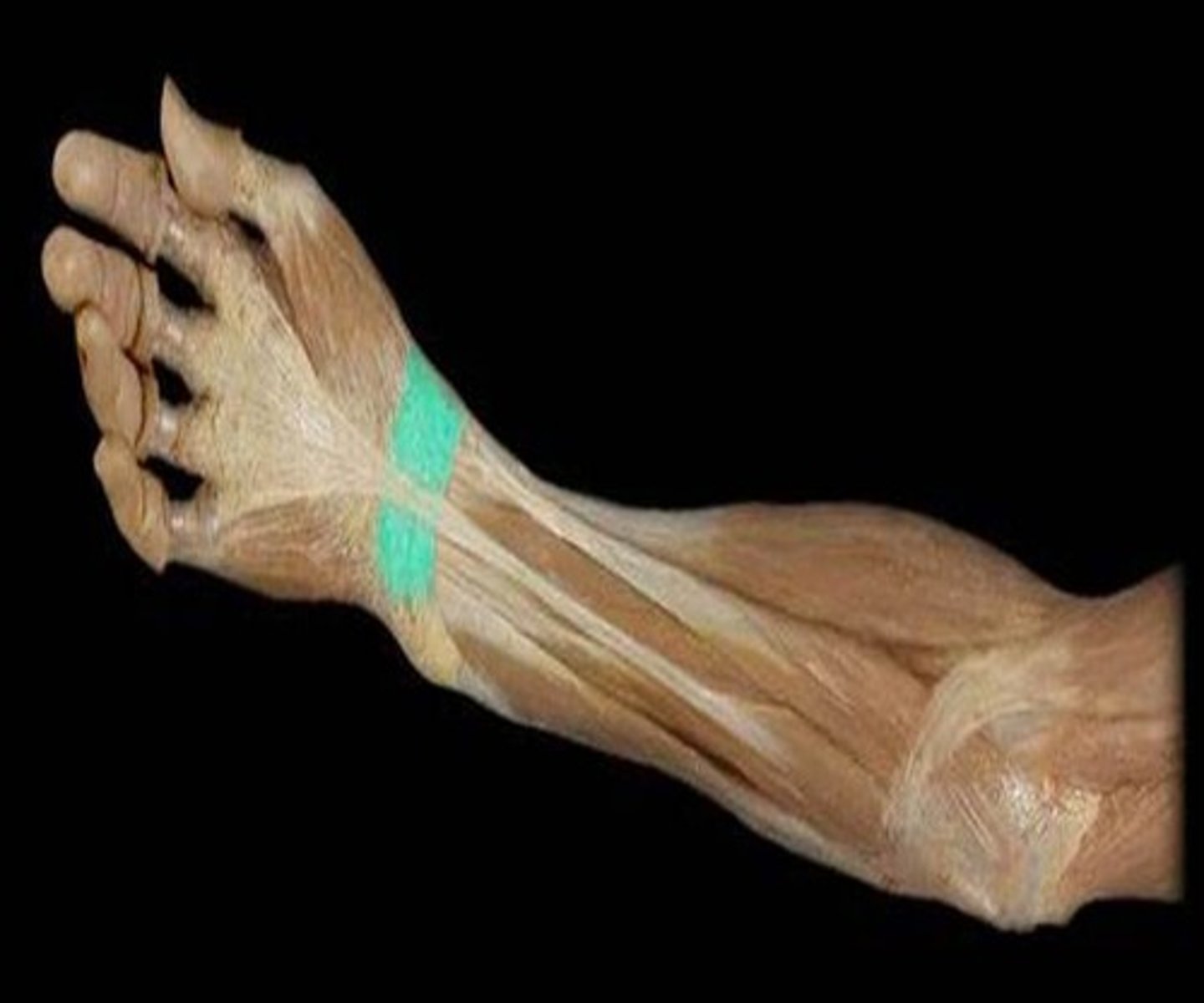 <p>Identify this connective tissue structure.</p>