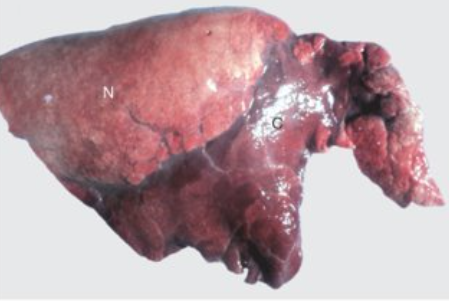 <p>What is this pneumonia/lung lesion</p>