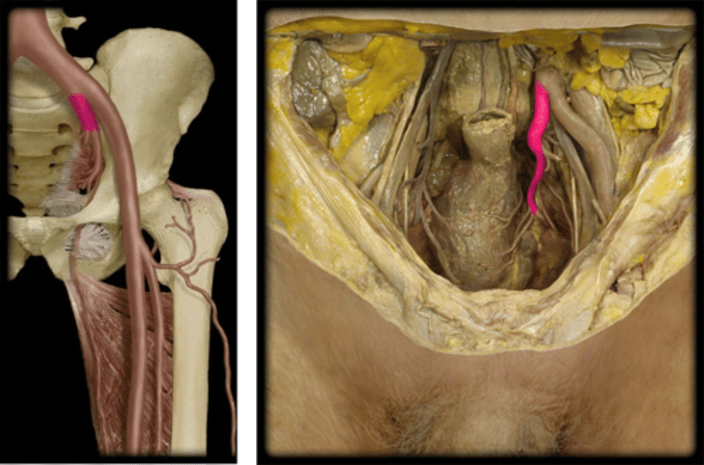 <p>Name this vessel.</p>