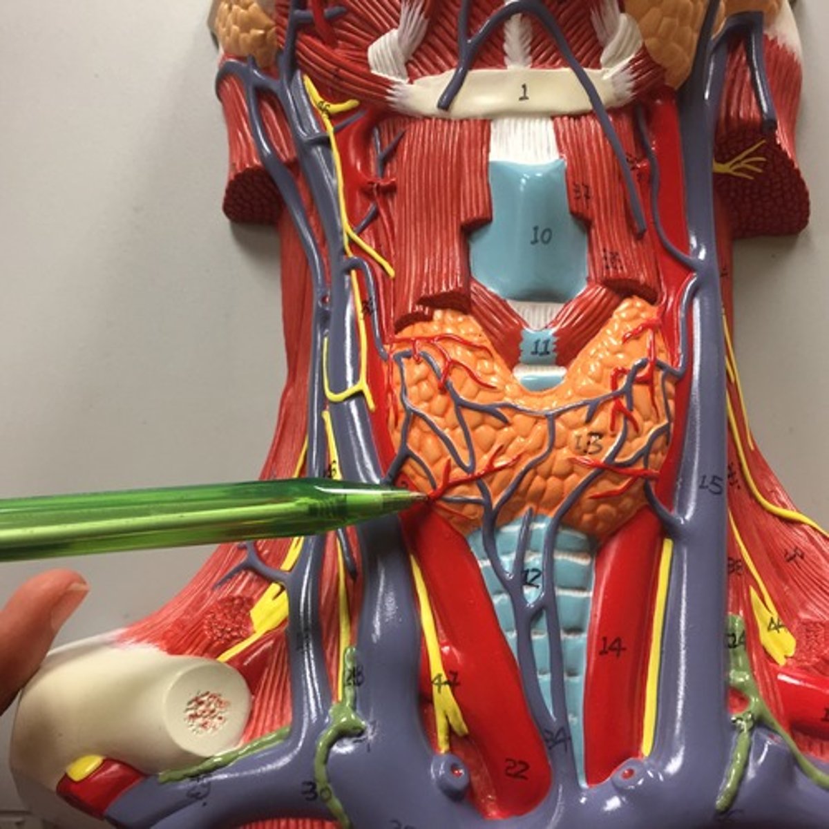 <p>The Inferior part of the thyroid is supplied by the Inferior Thyroid Artery - what is this a branch of?</p>