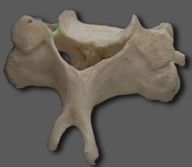 <p>what type of vertebra is this?  How do you know?</p>
