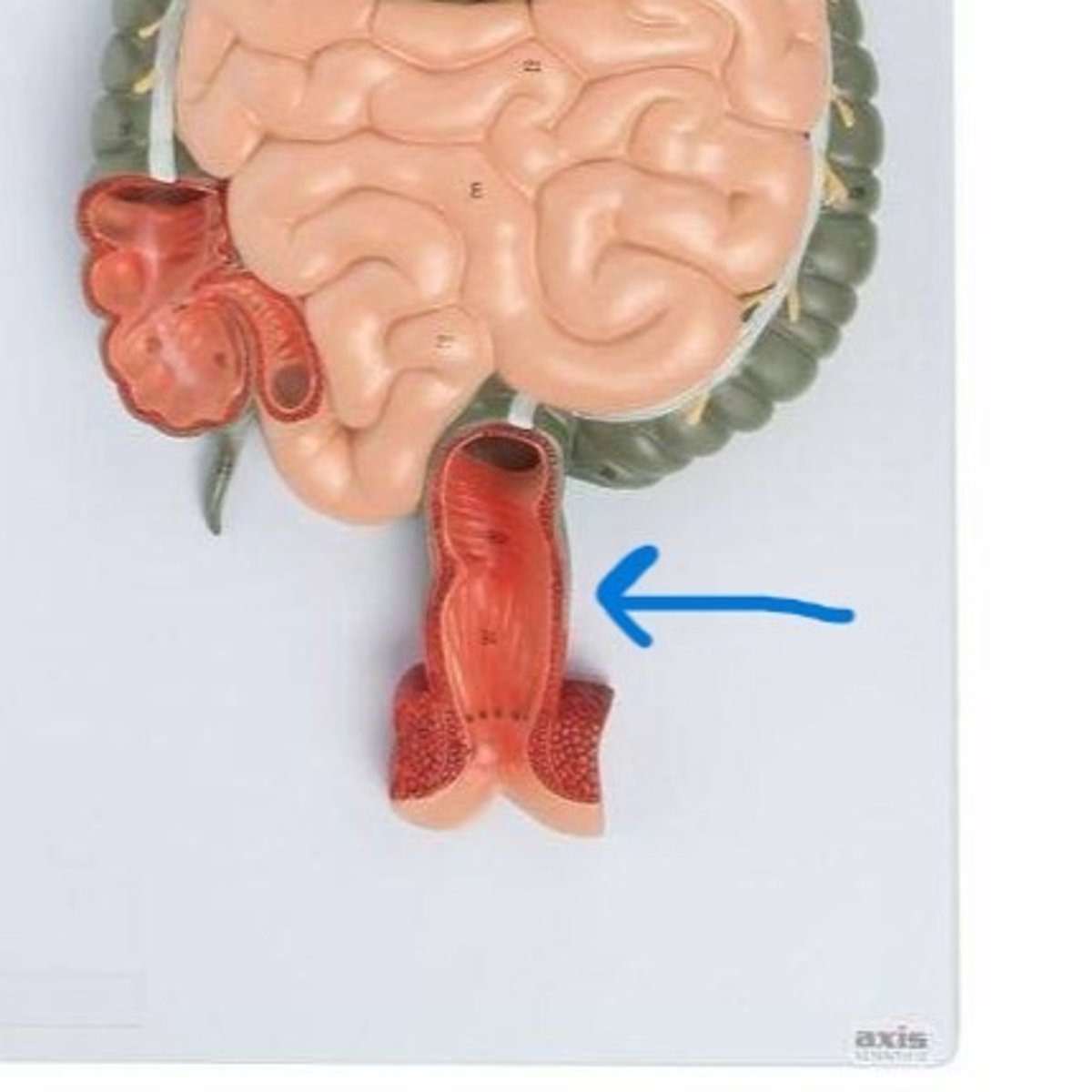 <p>What is this body feature?</p>