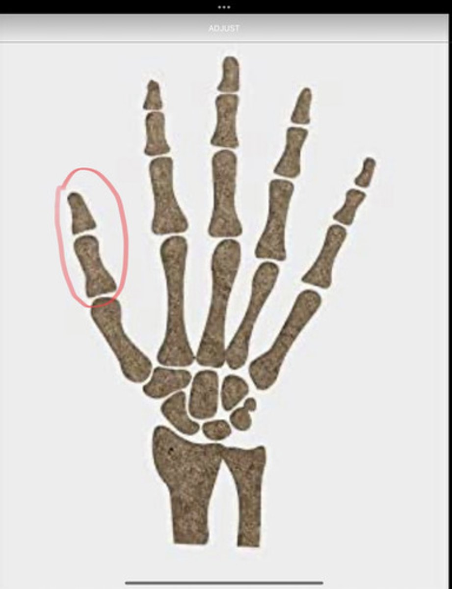 <p>first digit of the hand, first finger, or thumb..... lateral most finger</p>