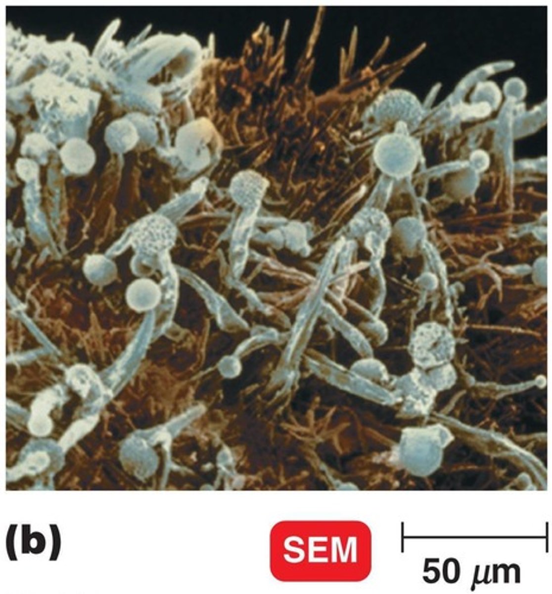 <p>Eukaryotic cells with a true nucleus.</p>