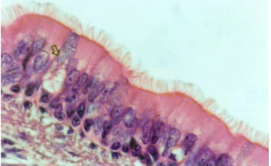 term image
