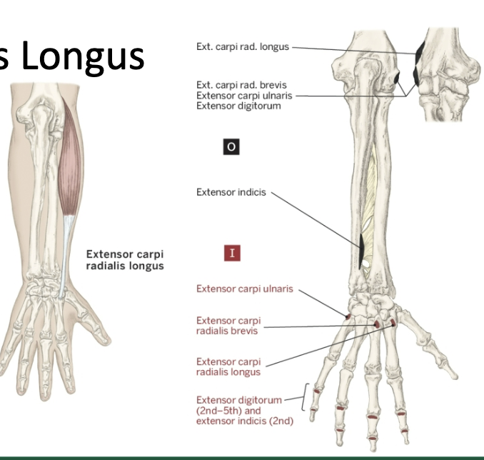 <p>Nerve that the Extensor Carpi Radialis Longus Innervates</p>