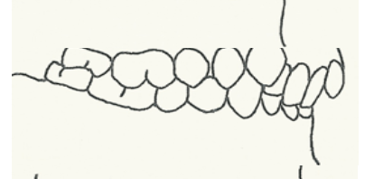 <p>Hier spreken we van een <span><strong><span>dekbeet</span></strong></span>. Hierbij overlappen de voortanden in de bovenkaak de voortanden in de onderkaak.</p>