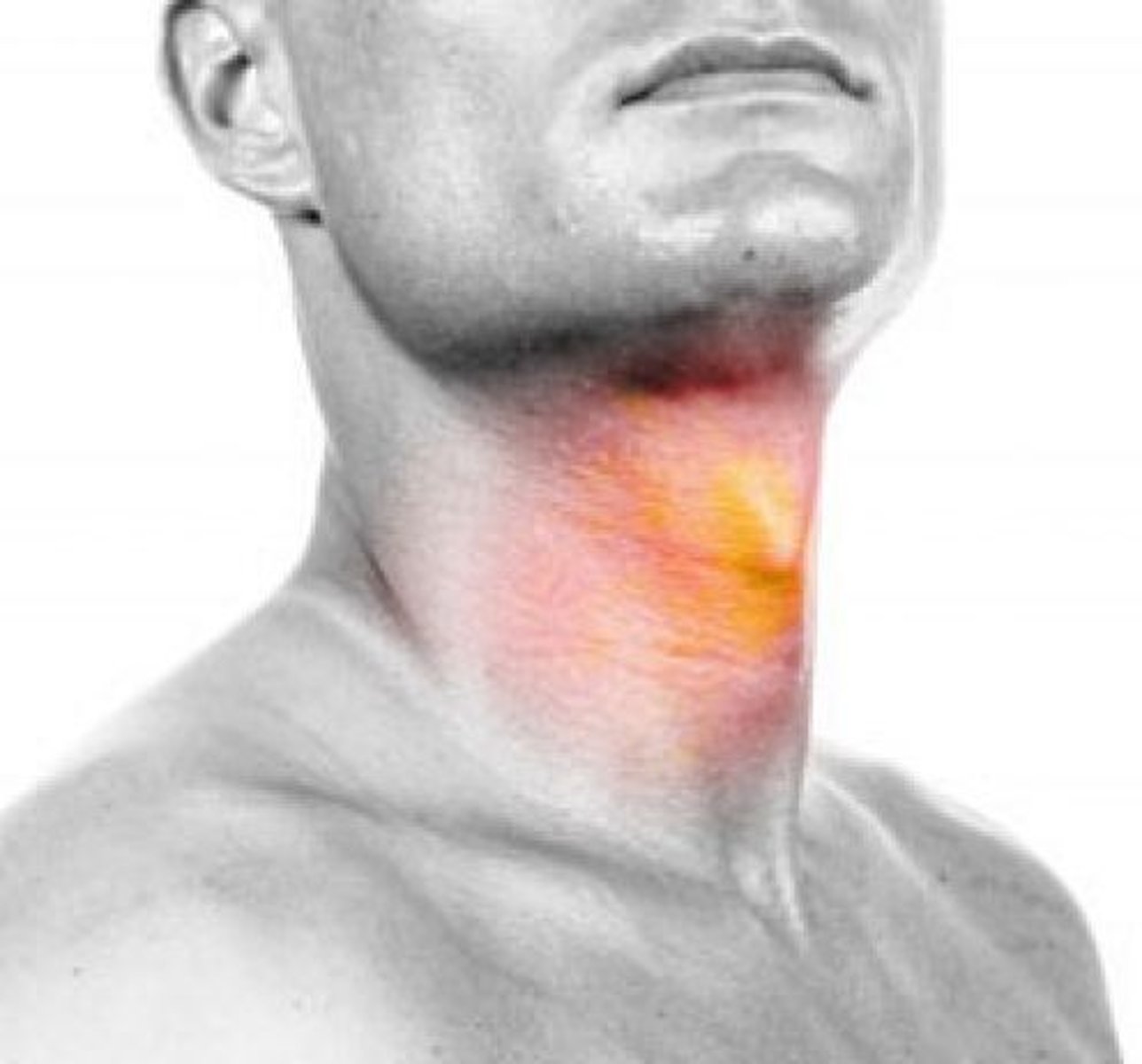 <p>front of neck</p>