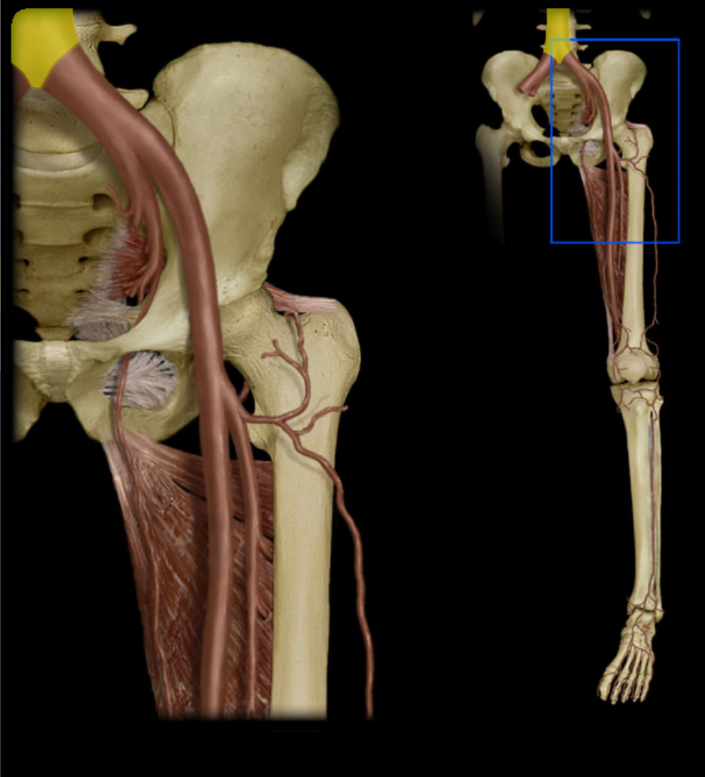 term image