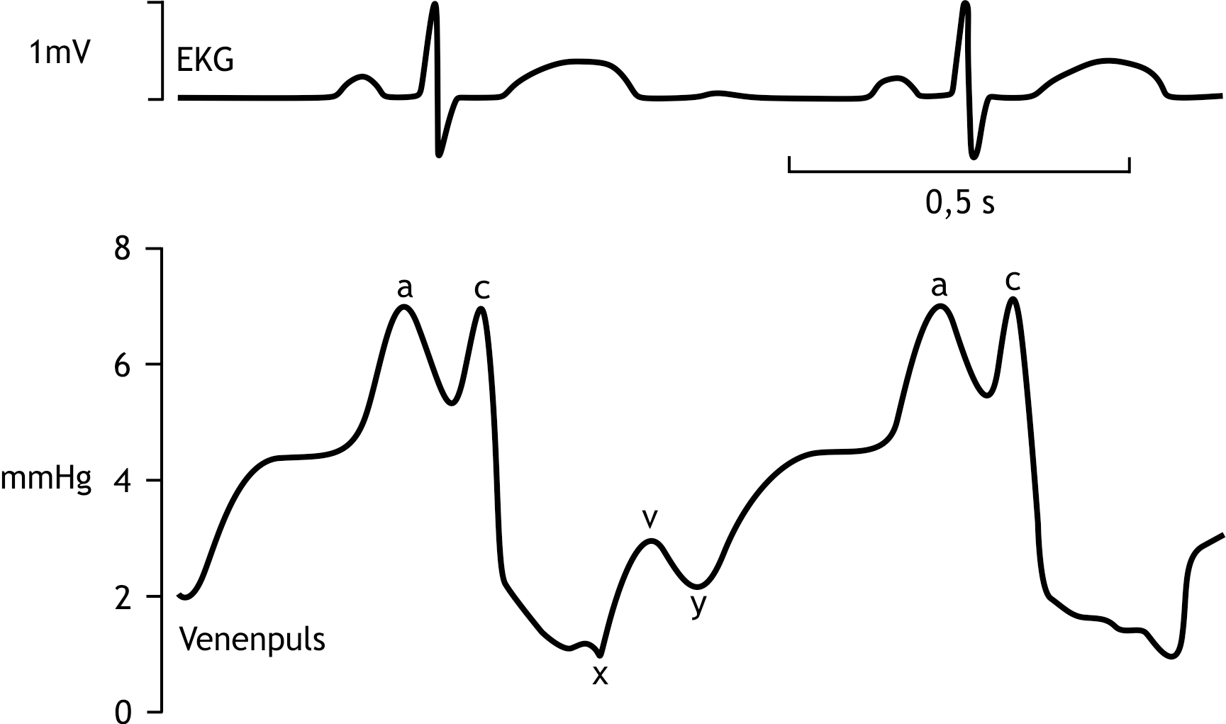 <p>45. In a supine person, the ECG and the pulse of a central vein are recorded simultaneously. The venous pulse roughly corresponds to the pressure curve in the right atrium, although the pressure changes show a slight delay due to transmission time to the pressure sensor.</p><p>Which part of the venous pulse curve most clearly demonstrates that the heart functions not only as a pressure pump but also as a suction pump for blood transport?</p><p>A. The course from c to x</p><p>B. The course from y to a</p><p>C. The a wave</p><p>D. The v wave</p><p>E. The y descent</p>
