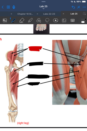 <p>What muscle is this?</p>