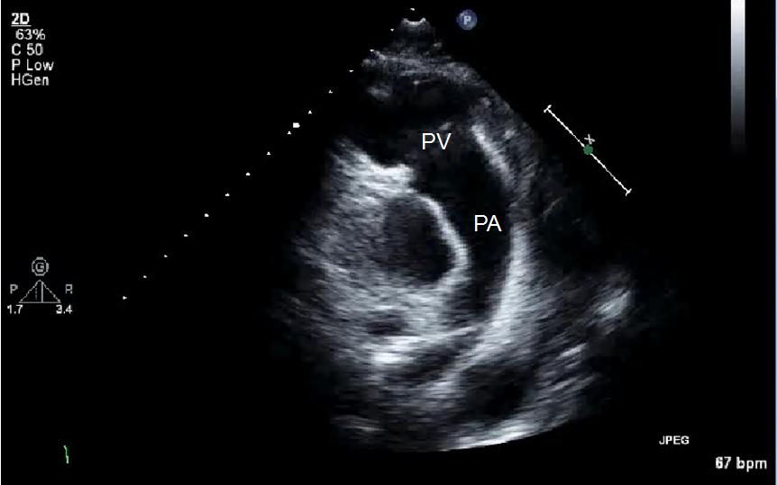 <p>By what other names is the RVOT view known?</p>
