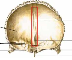 <p>posterior view</p>