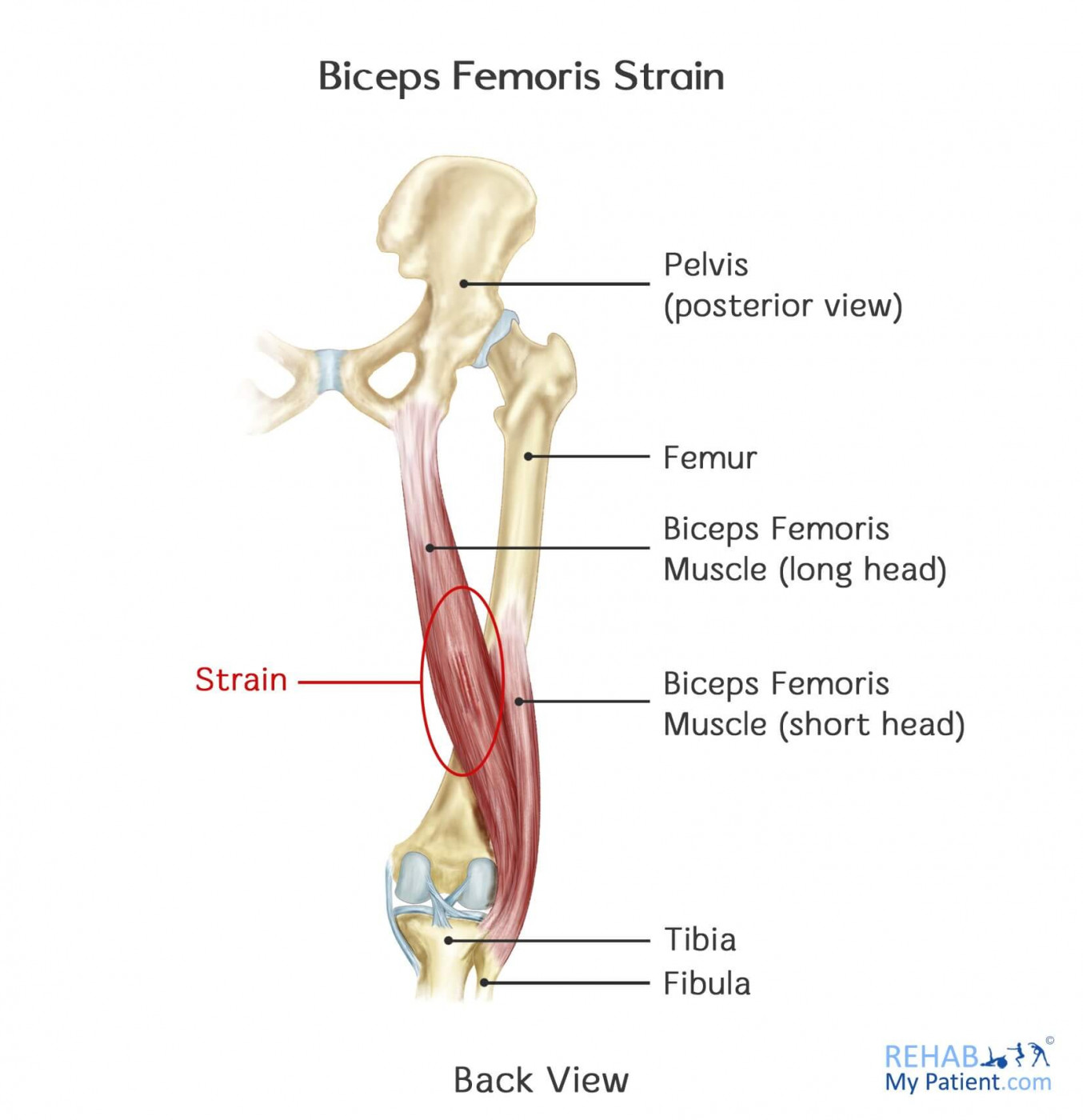 <p>Biceps Femoris </p>