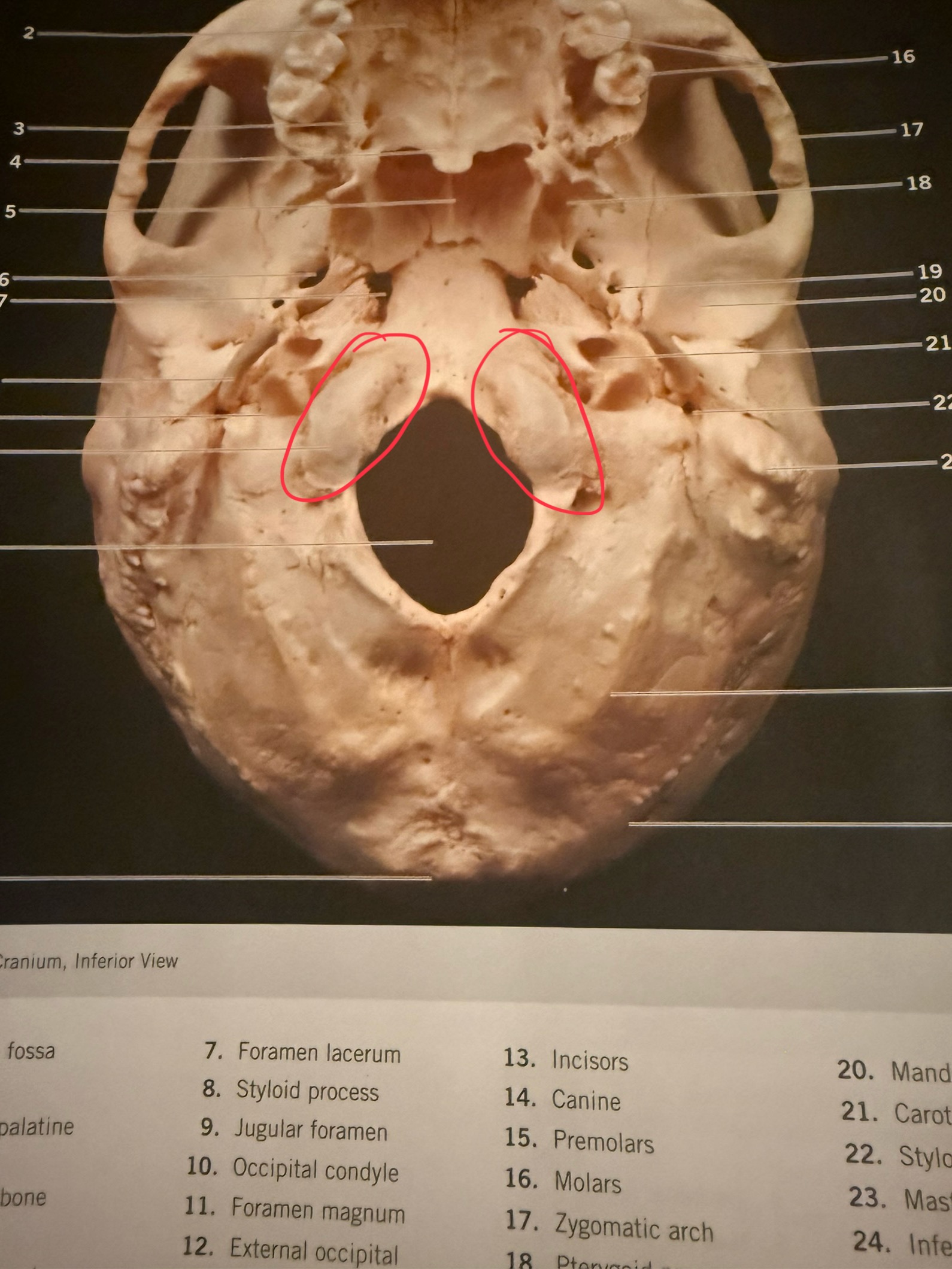 term image