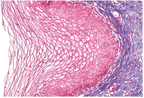 <p>Appearance: Same as keratinized but without the surface of dead cells </p><p>Function: Resists abrasion and penetration by pathogenic organisms </p><p>Locations: Tongue, oral mucosa, esophagus, anal canal, vagina </p>