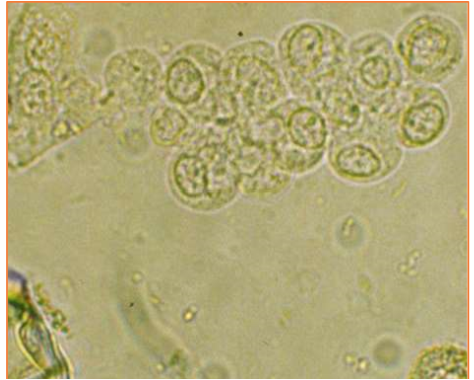 <p>These cells are present on sediment evaluation. What are they?</p>