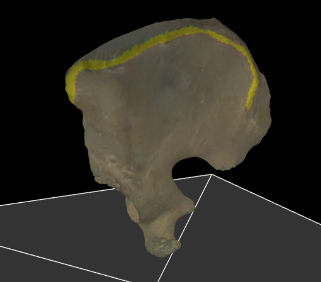 <p>De buitenste rand van de crista iliaca, die zich aan de zij- en voorkant van het bekken bevindt en ook als aanhechtingspunt voor spieren en ligamenten dient.</p>