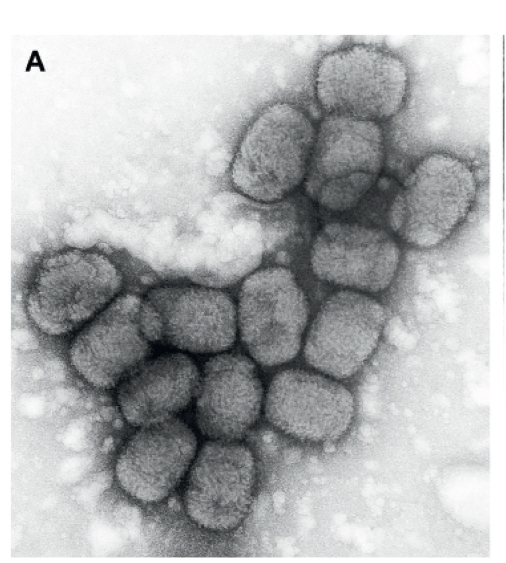 <p>-through electron microscopy, followed by PCR. Best results when the cell is loaded with the virus.</p><p>-usually produces rash and fever- mild.</p>