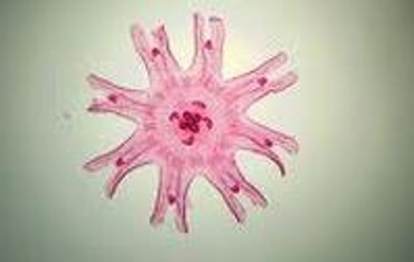 <p>Phylum?</p>