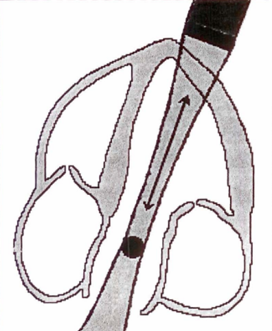 <p>single crystal sent &amp; received</p><ul><li><p>time gating device (sample volume) selects <strong>depth</strong> where returning signal originated</p><ul><li><p>sample volume is parallel to direction of flow</p></li></ul></li></ul><p></p>