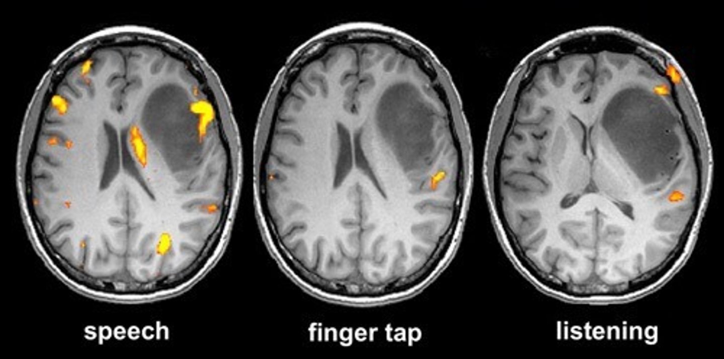 <p>a form of magnetic resonance imaging of the brain that registers blood flow to currently functioning areas of the brain</p>