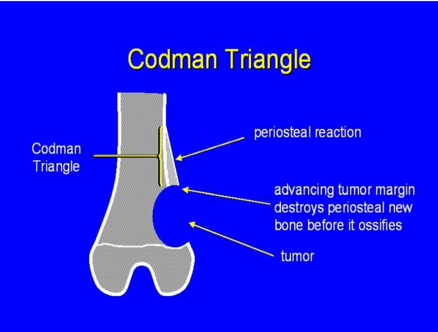 <p>Tumours can be divided into?</p>